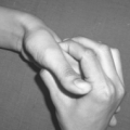 Acupressure Image 1
