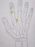 Acupressure Image 2
